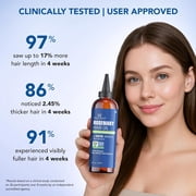 Botanic Hearth Rosemary Hair Oil 4 fl oz | 100% Pure & Natural | With Biotin, Jojoba & Castor Oils | Strengthens, Repairs & Nourishes Hair | Promotes Hair Growth & Healthy Scalp