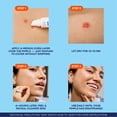 thumbnail image 4 of Biore Paint & Peel Liquid Pimple Patch with Salicylic Acid, up to 100 Uses, .5 oz, 4 of 14