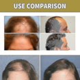 thumbnail image 4 of Jaysuing - Lápiz para sellar cejas con estampado de cejas, resistente al agua y al sudor, para reparar la línea del cabello, color marrón oscuro, 4 of 5