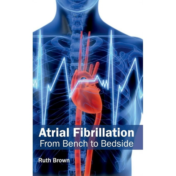 Atrial Fibrillation: From Bench to Bedside, (Hardcover)