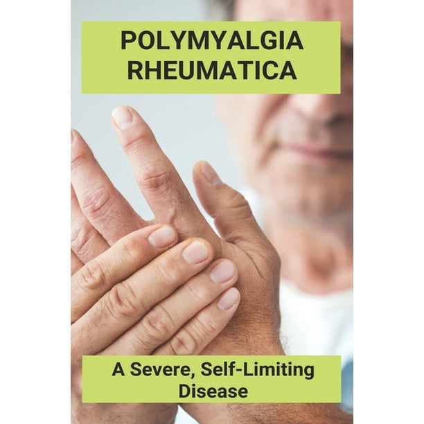 Polymyalgia Rheumatica: A Severe, Self-Limiting Disease: Polymyalgia