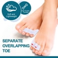 thumbnail image 4 of Separadores de dedos Povihome Triple Gel para dedos superpuestos, color rosa, 4 of 8