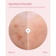 thumbnail image 3 of Parches hidrocoloides para manchas y espinillas GLAM UP 36 unidades, 3 of 4