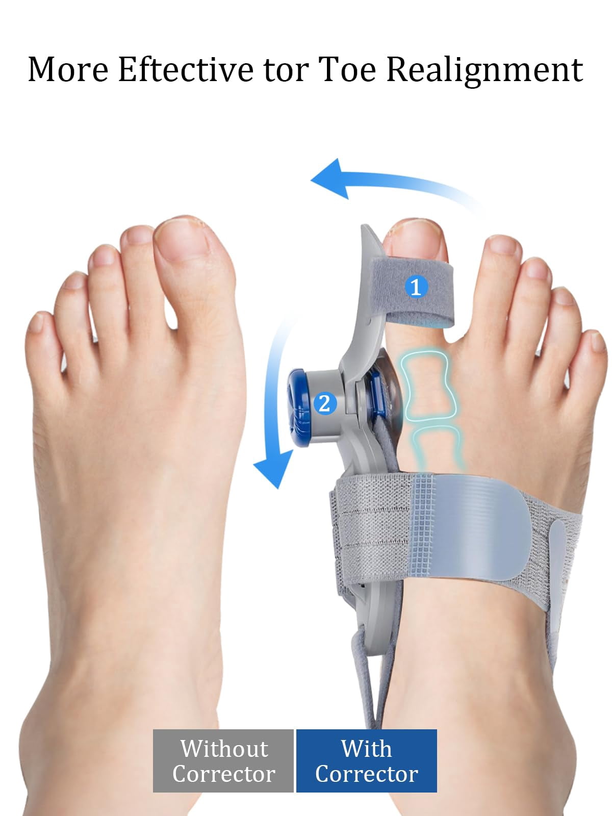 Pro V2 Adjustable Bunion Corrector Toe Straightener - Big Toe Pain Relief Support Splint for Men Women, One Size Fits All, Breathable Comfort