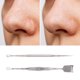 thumbnail image 5 of Ofertas Únicas 1 Juego de Extractor de Granos Facial Tono Plateado 4.92", 5 of 6