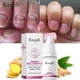thumbnail image 4 of Rtopr Ginger Nail Treat Ment Nail Toe Repair 10ml, 4 of 5