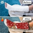 thumbnail image 7 of COEQINE Christmas Leg Cast Cover Highland Cow Outdoor Protection Leg Cover Anti Scratch Cast and Bandage Protector Easy to Clean Knee Cast Sock Christmas Gifts for Kids Girls Medium, 7 of 7