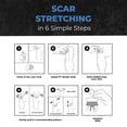 thumbnail image 4 of PT StrapZ Non-Elastic, Therapeutic Adhesive, Scar Tissue Mobilization, Scar Tissue Stretching, Therapeutic Tool to aid Recovery from Surgery or Trauma Health & Personal Care (20 strips, 4 of 7