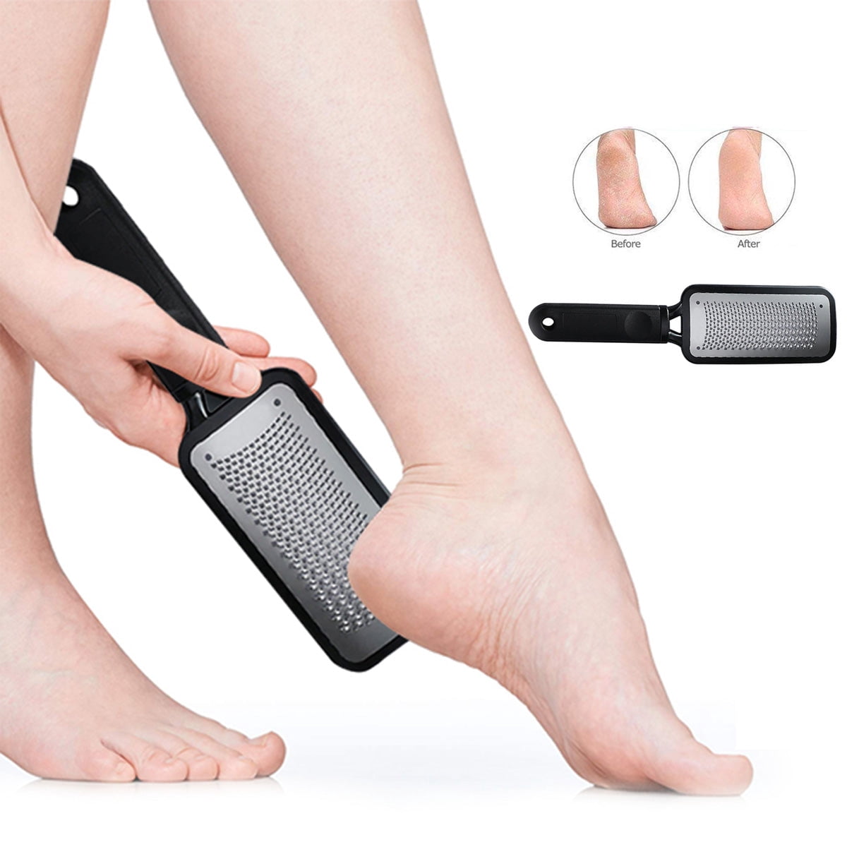Colossal Foot Rasp Foot File And Callus Remover - 2-Pack