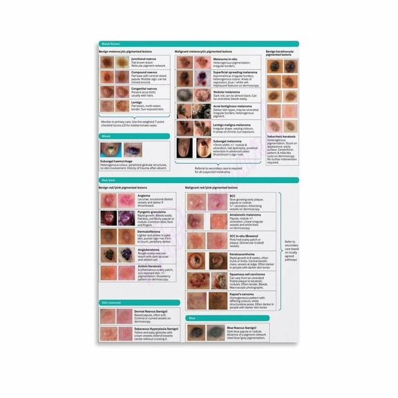 Skin Cancer Warning Signs Symptom Type Posters Canvas Painting Wall Art Poster for Bedroom Living Room Decor