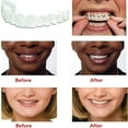 1 Pair Dental Veneers for Men and Women False Teeth Cover Imperfect