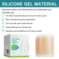 thumbnail image 4 of Cinta de Silicona Suave para Cicatrices para Quemaduras Queloides y acné No Irritante y Fácil de Aplicar Adecuada para Pieles Sensibles Todas las Edades Imita la Barrera ANGGREK  Otros, 4 of 8