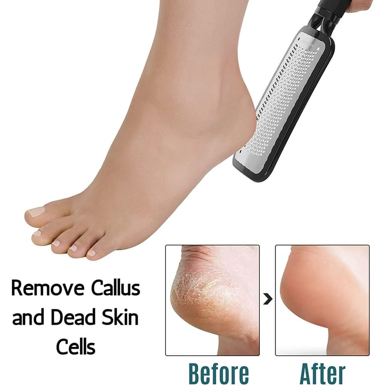 Slick Solutions Slick- Foot File Callus Remover, Foot Scraper for Dead Skin, Foot Scrubber, Foot Rasp, Heel Scraper, Foot Grater for Dead Skin, Callus