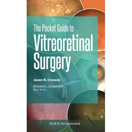 UPC: 9781630916961 | Pocket Guides: The Pocket Guide to Vitreoretinal Surgery (Paperback)