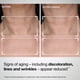thumbnail image 4 of Loción StriVectin TL Advanced Tightening FPS 35 45 ml, 4 of 9