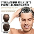 thumbnail image 4 of 3pcs Shampoo Root Activator, Root Activator Shampoo, SPARTAN Hair Loss Shampoo, 4 of 5