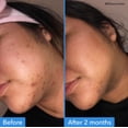 thumbnail image 3 of Serum Good Molecules, corrector de decoloración, 30 ml (paquete de 2), 3 of 8