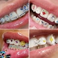 thumbnail image 4 of ROZYARD Tooth Gems Kit Teeth Crystals Jewelry Kit Fashionable Teeth Gems Kit Artificial, 4 of 15