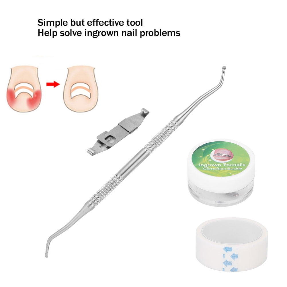 Aramox 3pcs Ingrown Toenail Corrector Paronychia Treatment Nail