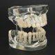 thumbnail image 5 of Modelo de dientes Equipo de enseñanza dental primario, modelo transparente Caducifolio para uso en laboratorio de hospital de jardín de infantes, 5 of 9