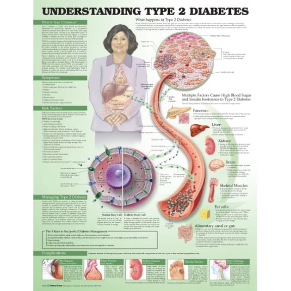 Pre-Owned Understanding Type 2 Diabetes Anatomical Chart