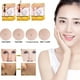 thumbnail image 3 of Laser Plasma Skin Beauty Pen Mole Remover Herramienta de eliminación de manchas oscuras TUNC Sencillez, 3 of 4