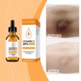 thumbnail image 4 of Hot6sl Ofertas de La Semana Vitamina C Blanqueadora Ilumina Hidrata Repone Agua Aclara Líneas Hidrata Blanquea y Cuidado Antienvejecimiento 60Ml, 4 of 7
