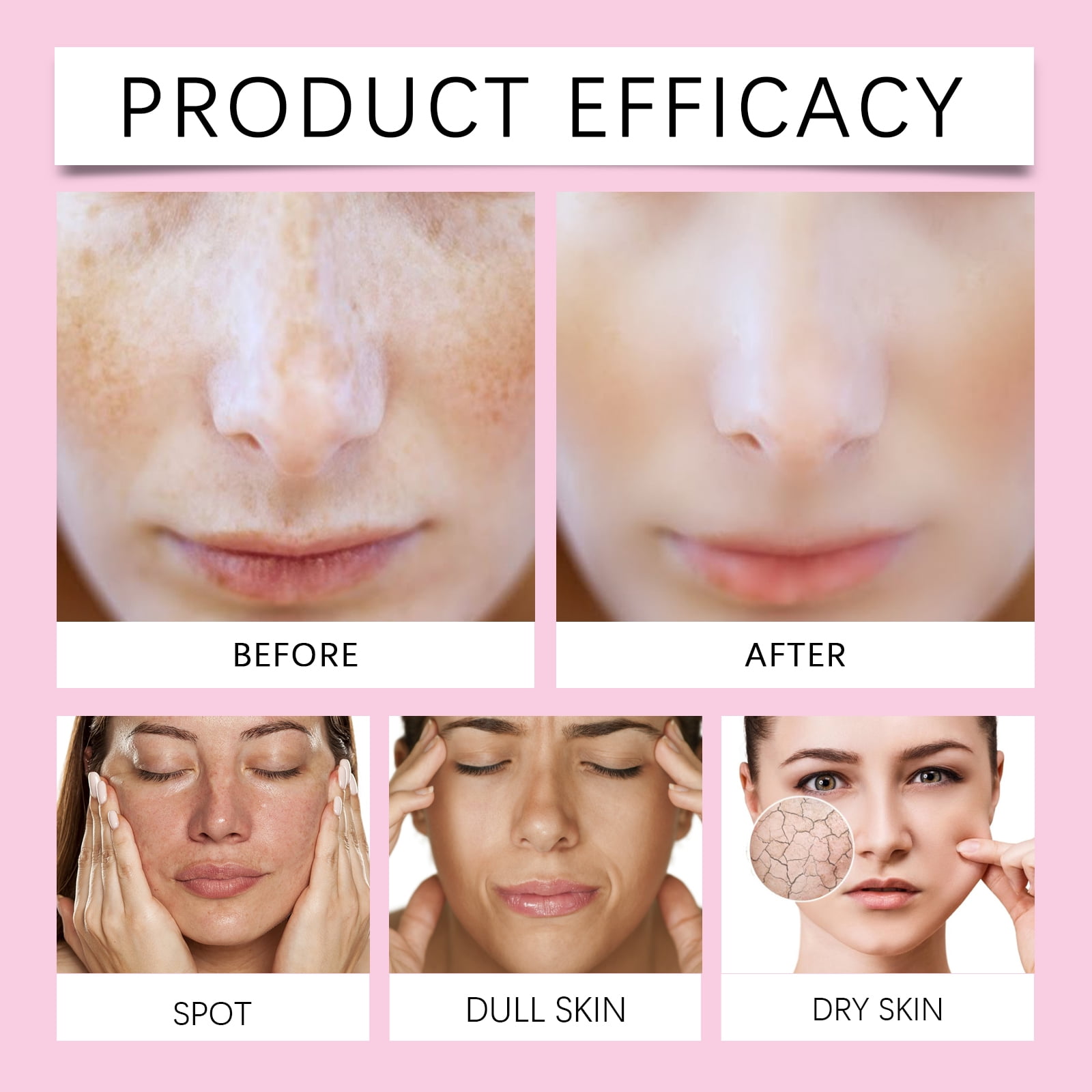 Alvantor Face Cream with Kojic Acid Firming Moisturizer for Face and Body 1.76oz