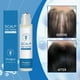 thumbnail image 2 of 1-3X Scalp Hair Dense Serum Roll- On, Rosemary Hair Thickening Roll-On NEW, 2 of 5