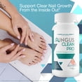 thumbnail image 5 of Fungus Clean Pro - Probiotic Fungus Inhibitor - Fight Off Fungus from The Inside Out with This Powerful Fungus Defense probiotic Protect Your Body from Fungus, 5 of 8