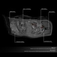 thumbnail image 2 of NUVISION for 02-05 Dodge Ram 1500 2500 3500 Smoked Lens Clear Corner Headlight Lamps, 2 of 8