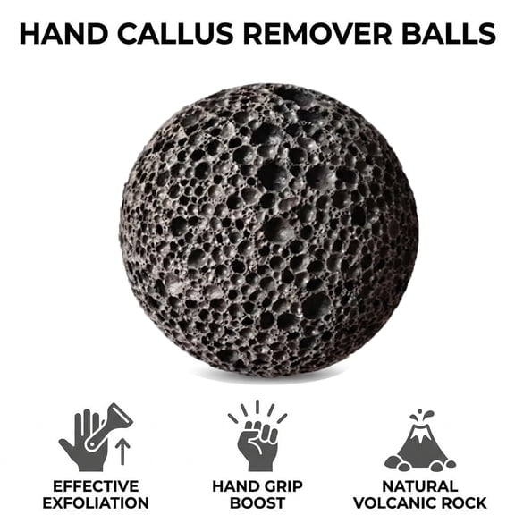 2026 New Callus_Ball For Hand, Moon_Round Grip Ball Callus Rock, Hand Grip Strength Trainer For Rock-Solid Hands Rock Climbing Grip Trainer, Anti-Sweat Grip Strengthener