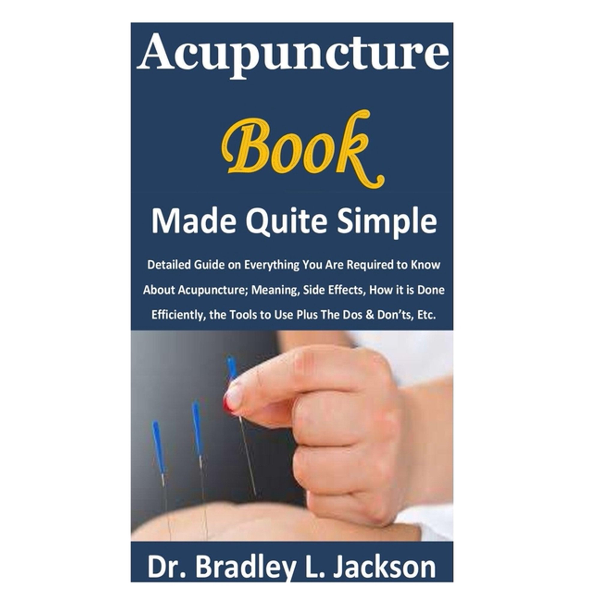 Acupuncture Book Made Quite Simple: Detailed Guide on Everything You Are Required to Know About Acupuncture; Meaning, Side Effects, How it is Done Efficiently, the Tools to Use Plus The Dos & Don'ts,