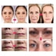 thumbnail image 2 of El nuevo kit especial de rodillo Derma de 1 pieza, 2 of 3