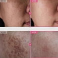 thumbnail image 2 of TOSOWOONG Arbutin 7% + Tranexamic Acid 4% Cream 50g, 2 of 5