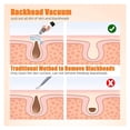thumbnail image 5 of XIRQI Pore Vacuum,Usb Rechargeable Blackhead Remover Vacuum,3 Levels Adjustable Pore Vacuum Blackhead Remover,With 5 Suction Power,6 Probes,Face Vacuum Pore Cleanser for Women And Men (White), 5 of 7
