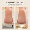 thumbnail image 3 of Electric Callus Remover for , Rechargeable Foot  with Digital Display, 3 Roller Heads & 2 Speeds - Professional Pedicure Tools for  Hard Cracked Dry  (White), 3 of 6