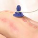 thumbnail image 4 of Palo De Masaje De Punto De Acupuntura, Meridianos Pat Stick Alivio De Fatiga De Presión Negativa Azul Para Hombro Cuello, 4 of 8