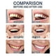 thumbnail image 4 of New Teeth Whitening Essences Extra Strong White Hygiene Tooth Whitener Stain Removal Oral Hygiene Whitening Gel Remove Plaque And Stains Cleaning Tw,3Set, 4 of 5