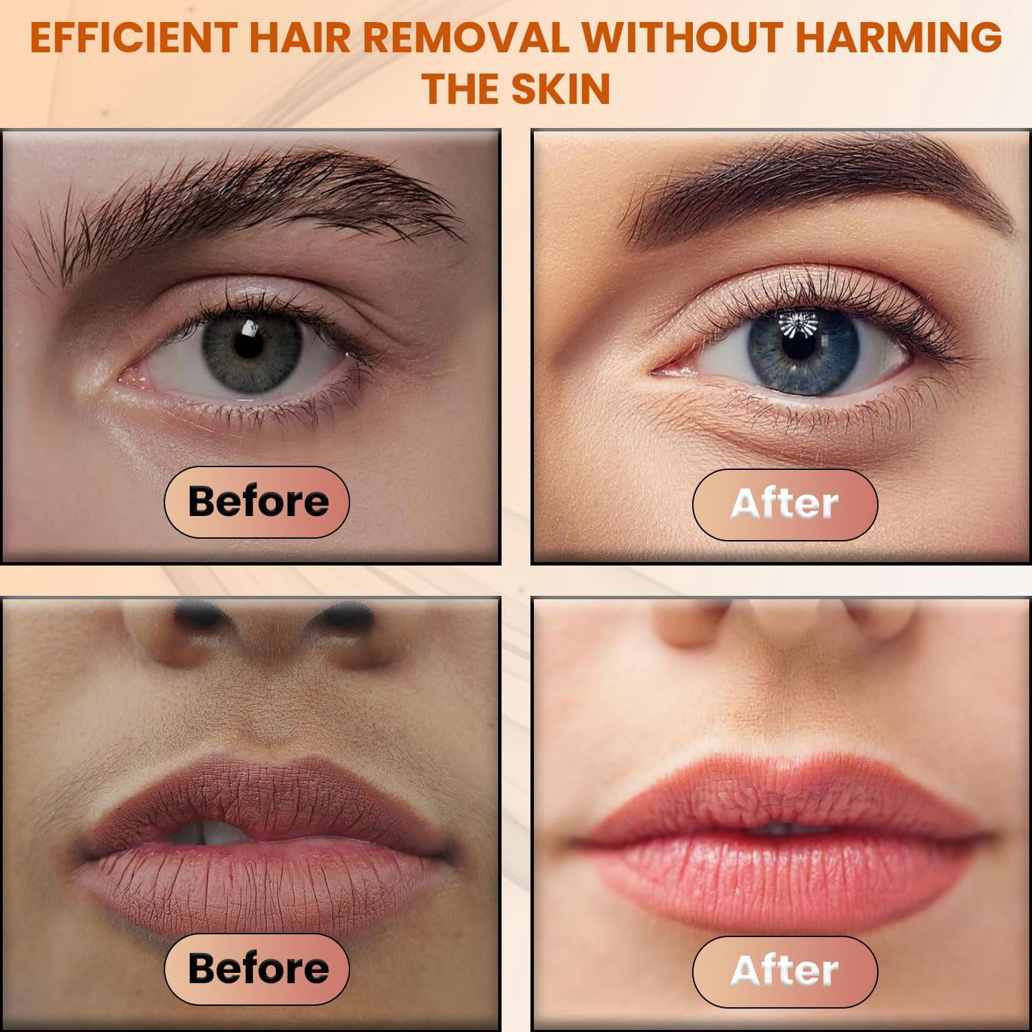 Facial Hair Remover for Women – Electric Face Razor with Light, Hair Removal for Upper Lip, Chin & Cheeks – Color White