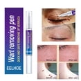 thumbnail image 3 of Yeso De Eliminación De Verrugas Crema de tratamiento corporal para eliminación de verrugas, removedor de marcas en la piel, yeso medicinal a base de hierbas Ndcxsfigh Cuidado Belleza, 3 of 8