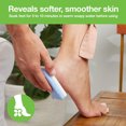 thumbnail image 4 of Foot Scrubber File To Remove Calluses Horny Foot Scrub Foot Care Two-Color Foam Glass Foot Grinder - 2pcs blue white, 4 of 5