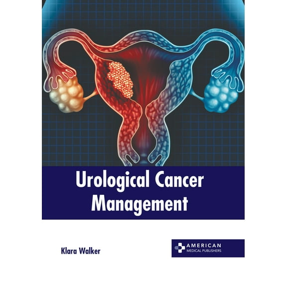 Urological Cancer Management, (Hardcover)