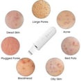 thumbnail image 5 of Xiyztok Facial Skin Scrubber USB Rechargeable Electric Ultrasonic Face Skin Spatula with 250mAh Battery and 4 Modes Portable Pore Deep Cleansing Blackhead Scraper Skin Care Beauty Tool, 5 of 10