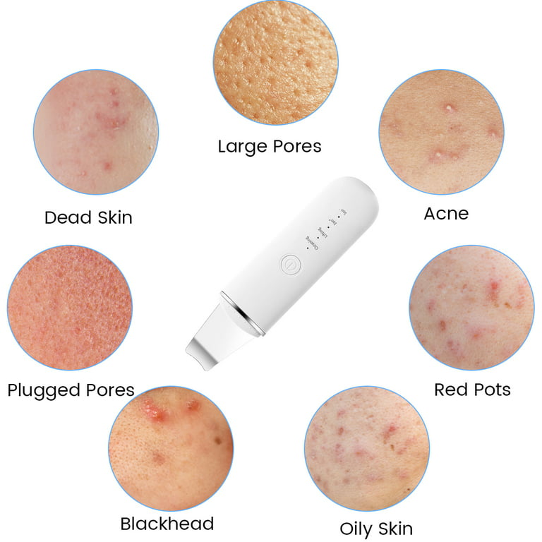 Zendure Face Skin Scrubber, IPX5 Waterproof Skin Spatula Blackhead Remover  Pore Cleaner Face Scraper Beauty Device 