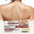 thumbnail image 2 of SOUTH MOON 20g Scar Recovery Cream Scar Treatment for Surgical Scars, Stretch Marks, Scars of Burns, 2 of 5