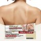 thumbnail image 2 of SOUTH MOON 20g Scar Recovery Cream Scar Treatment for Surgical Scars, Stretch Marks, Scars of Burns, 2 of 5