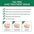 thumbnail image 2 of ZHAOCHENG 1/2 piezas de suero para el tratamiento del acné con árbol de té, cuidado de la piel, eliminación de cicatrices de acné, antiinflamatorio, reparación de espinillas, 2 of 5