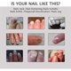 thumbnail image 2 of 1/2/3pcs Nail Repair - Nail Treatment Repair Gelnail & Toenail Treatment Nail Repair Cream Health Instant Beauty Cream Renews Yellow & Cracked, 2 of 4