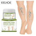 thumbnail image 1 of Eelhoe, crema para aliviar las venas varicosas, vasculitis, flebitis, araña, ungüento para aliviar el dolor, yeso médico, cuidado corporal, 50g Sincero Hogar, 1 of 6